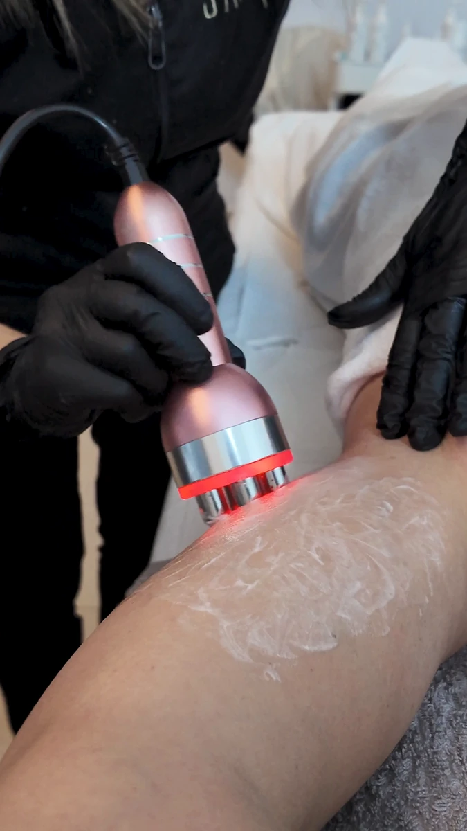 BodyLift RF, tratamientos corporales en Sapphira Privé, clínica estética en San Fernando