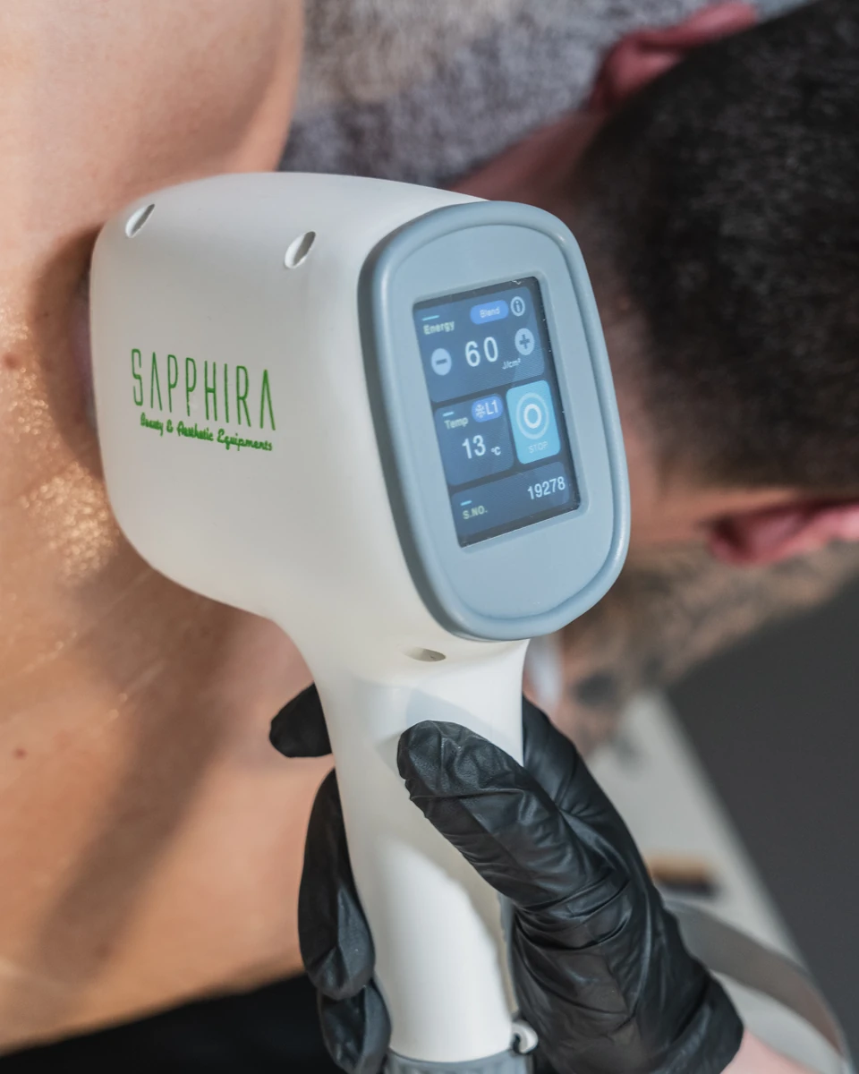 Eliminación de tatuajes en Sapphira Privé, clínica estética en San Fernando