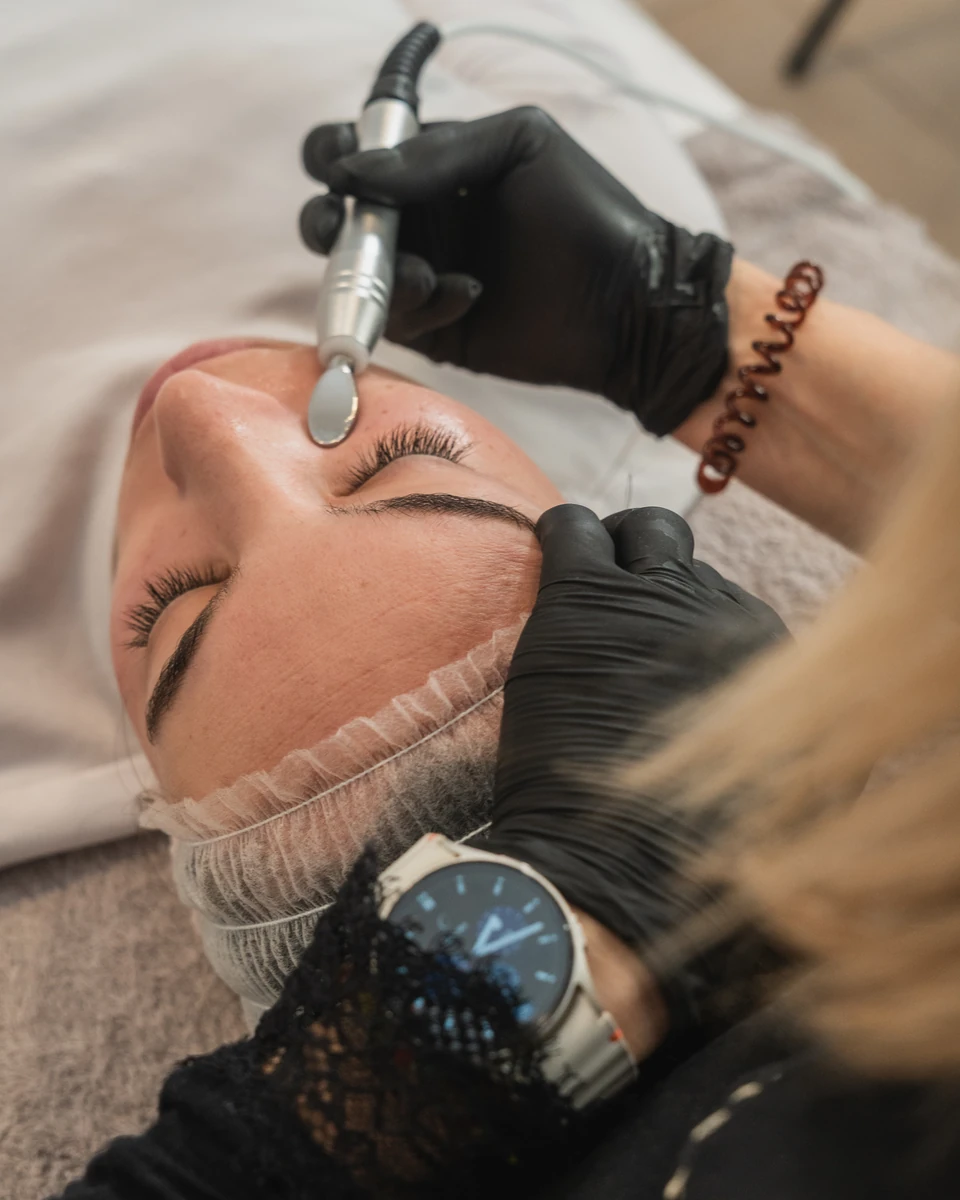 Plasma Pen en Sapphira Privé, clínica estética en San Fernando